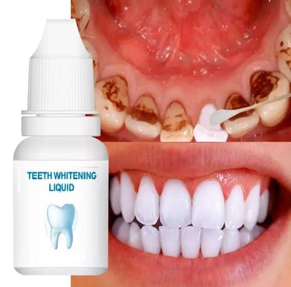 Teeth Whitening Serum Gel Dental Oral Hygiene Effective Remove Stains Teeth Whitening